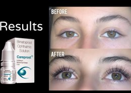 Best Place To Buy Careprost Online | Genericaura
