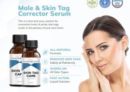 Safe, Effective & Natural: CharmHealth Skin Tag Remover Reviewed”